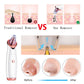Blackhead Remover