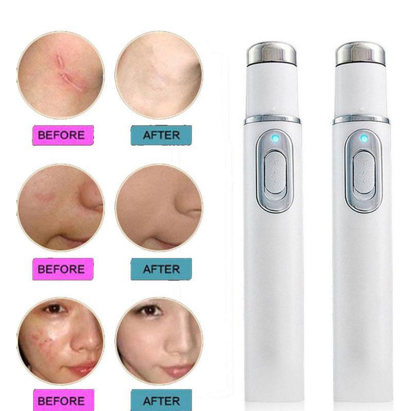Laser Wrinkle Remover